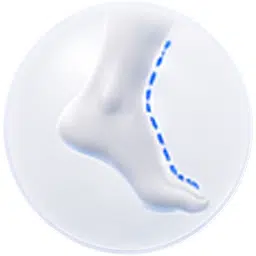 Voetverkleining